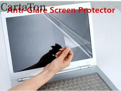 2PCS Anti-Glare reflexion Matt – Matte Anti Glare Screen Protector Bewertung und Preis